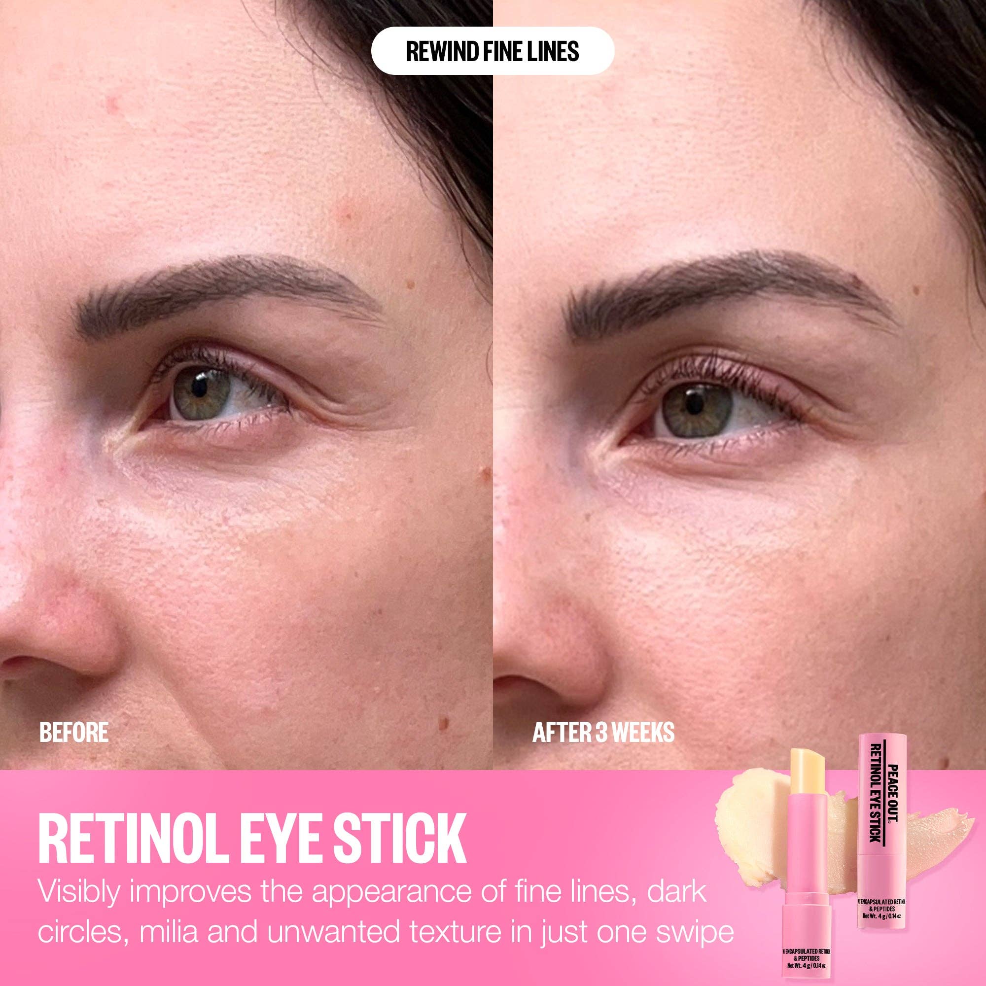 Retinol Eye Stick