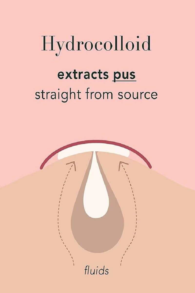 ,....1028 The Original Hydrocolloid Acne Pimple Patch  SI-27832