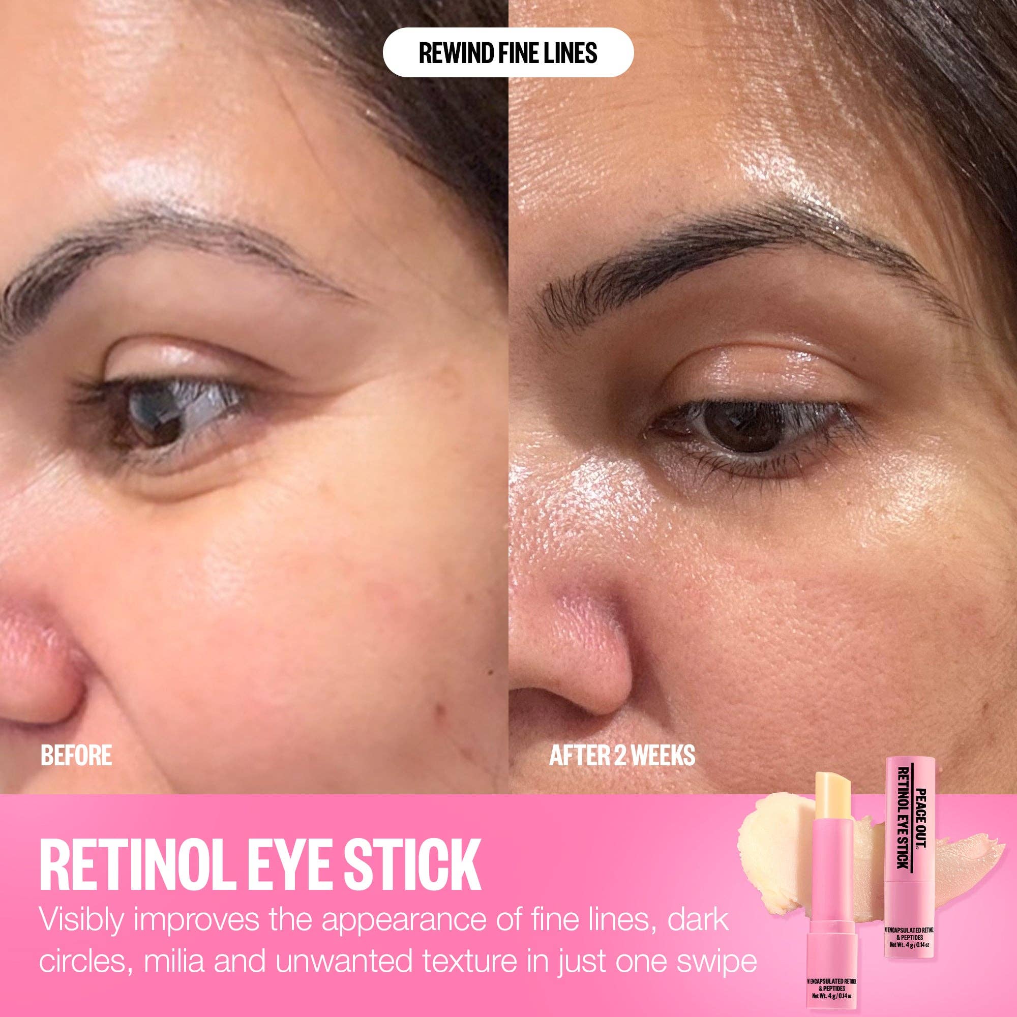 Retinol Eye Stick