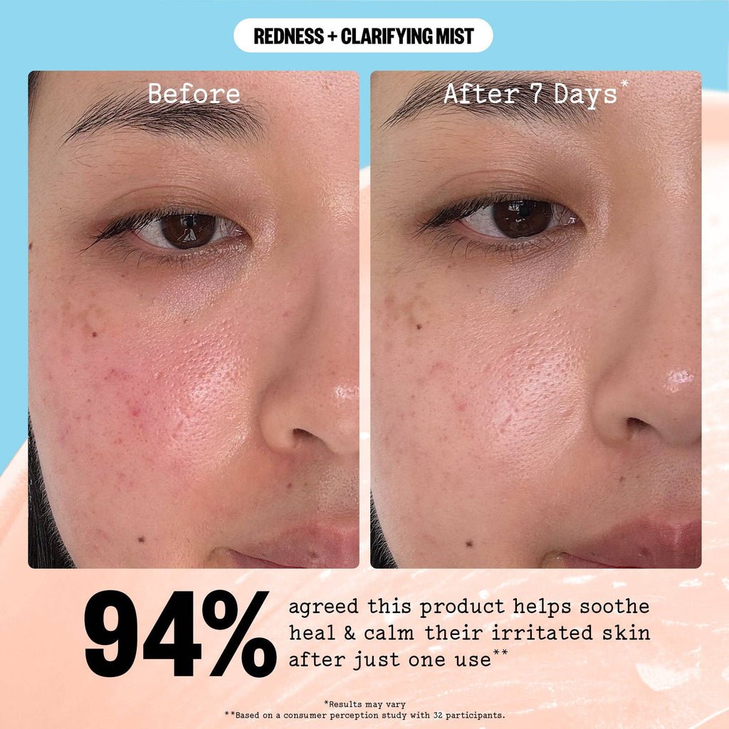 Redness + Clarifying Mist