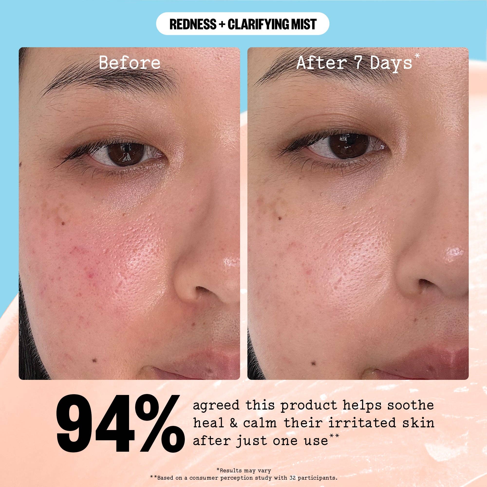 Redness + Clarifying Mist