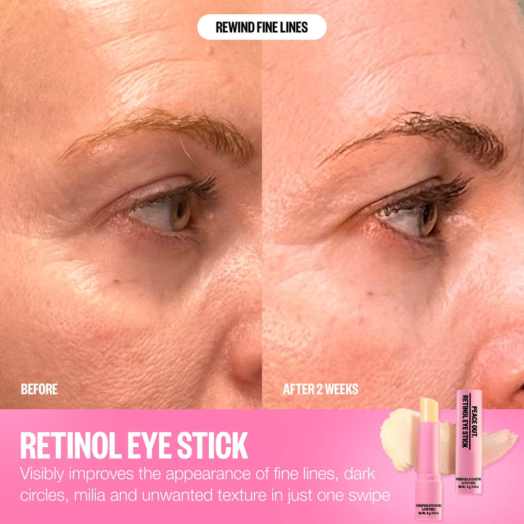 Retinol Eye Stick