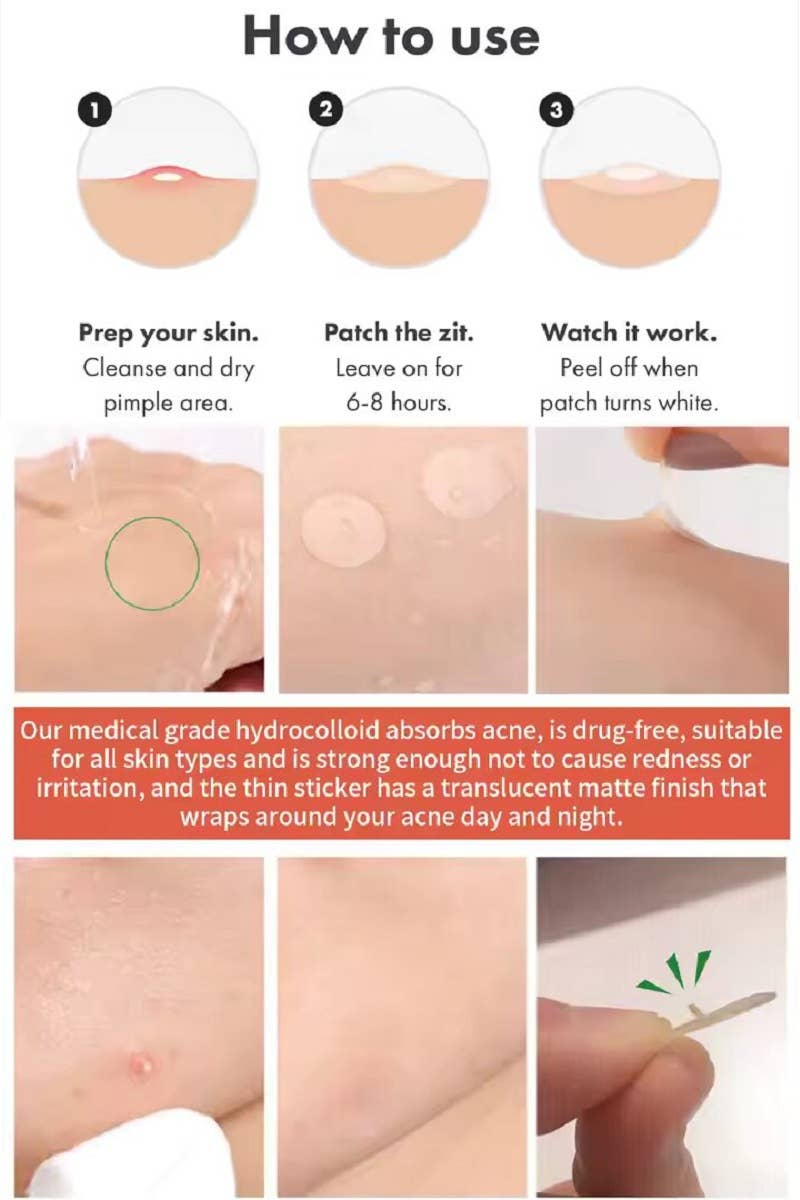 ,....1028 The Original Hydrocolloid Acne Pimple Patch  SI-27832
