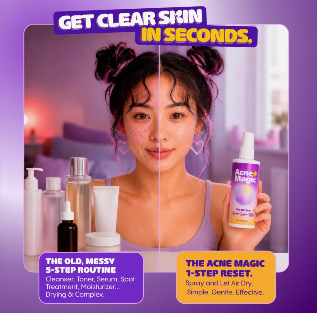 Acne Magic Clear Skin Spray