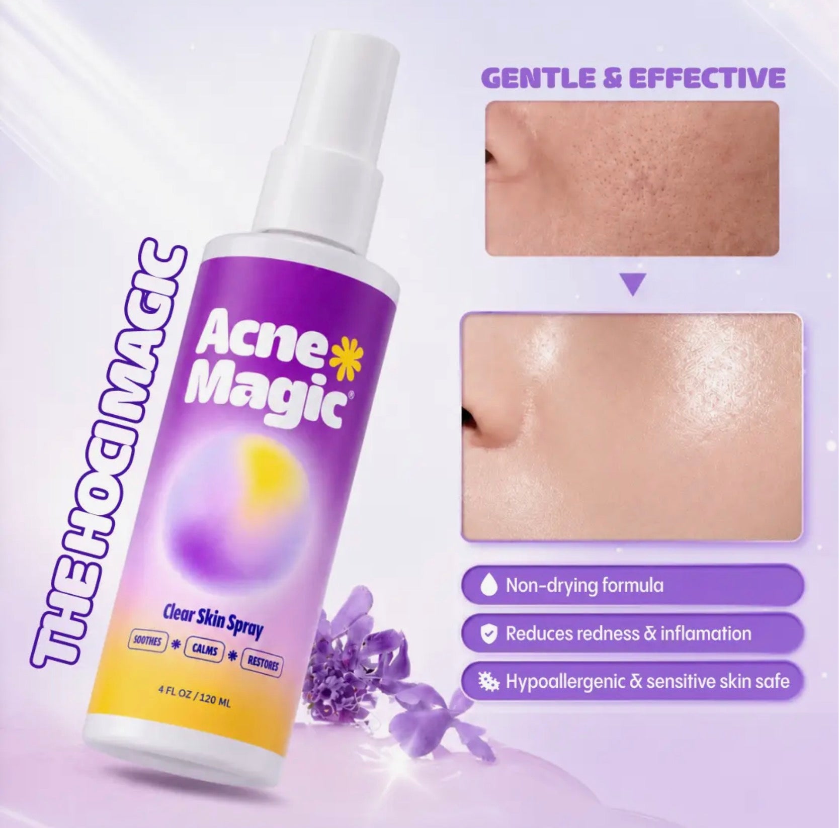 Acne Magic Clear Skin Spray