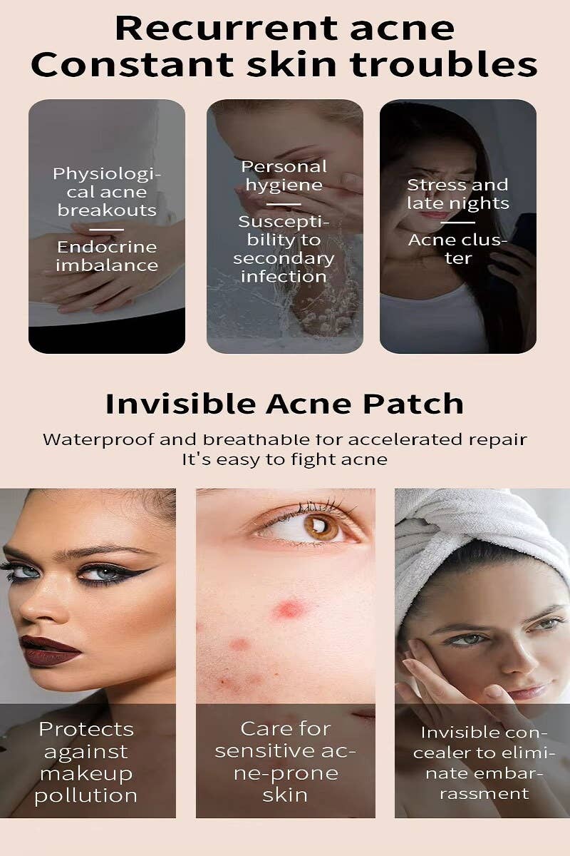 ,....1028 The Original Hydrocolloid Acne Pimple Patch  SI-27832