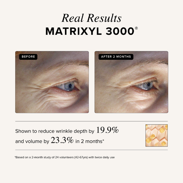 Triple Repair Moisturizing Cream