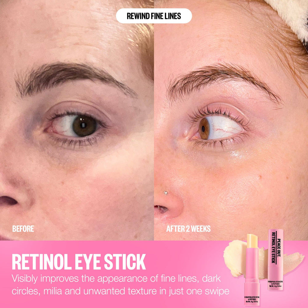 Retinol Eye Stick