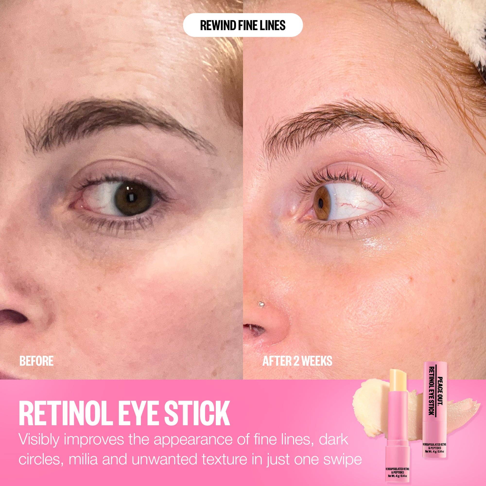 Retinol Eye Stick