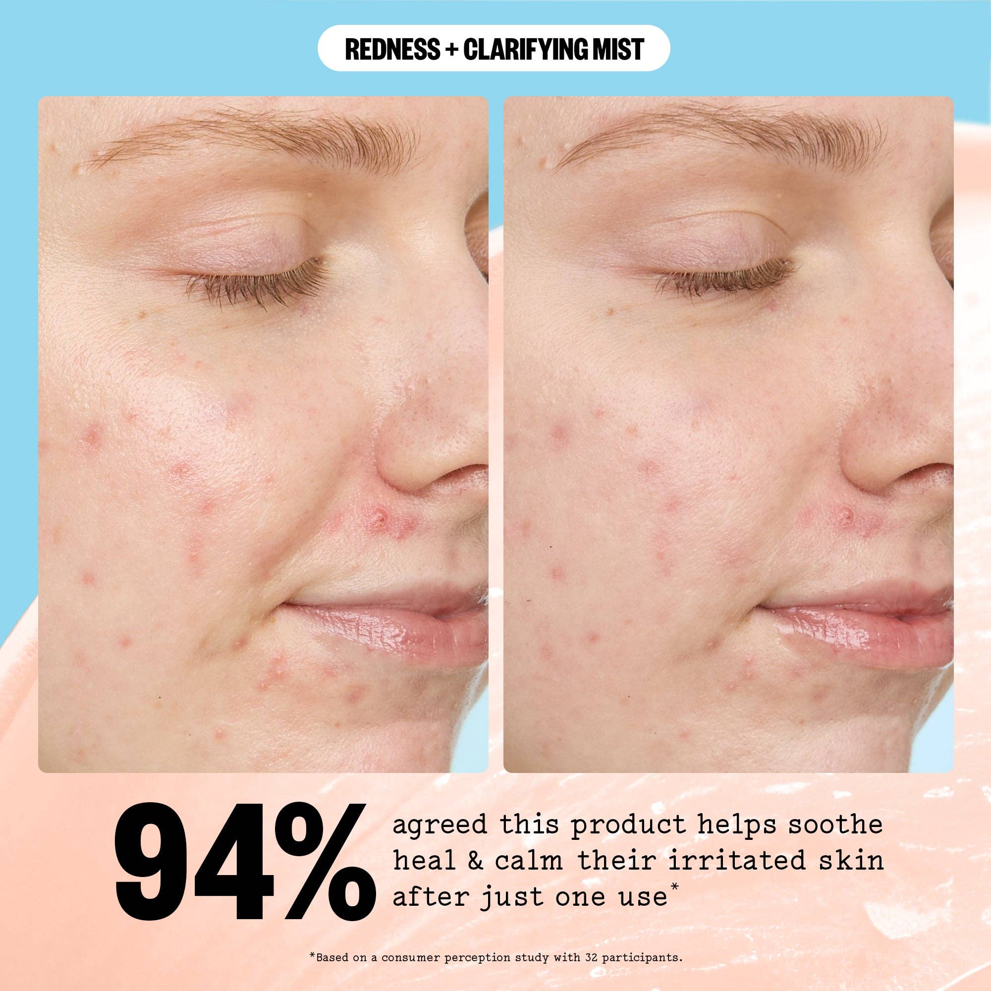 Redness + Clarifying Mist