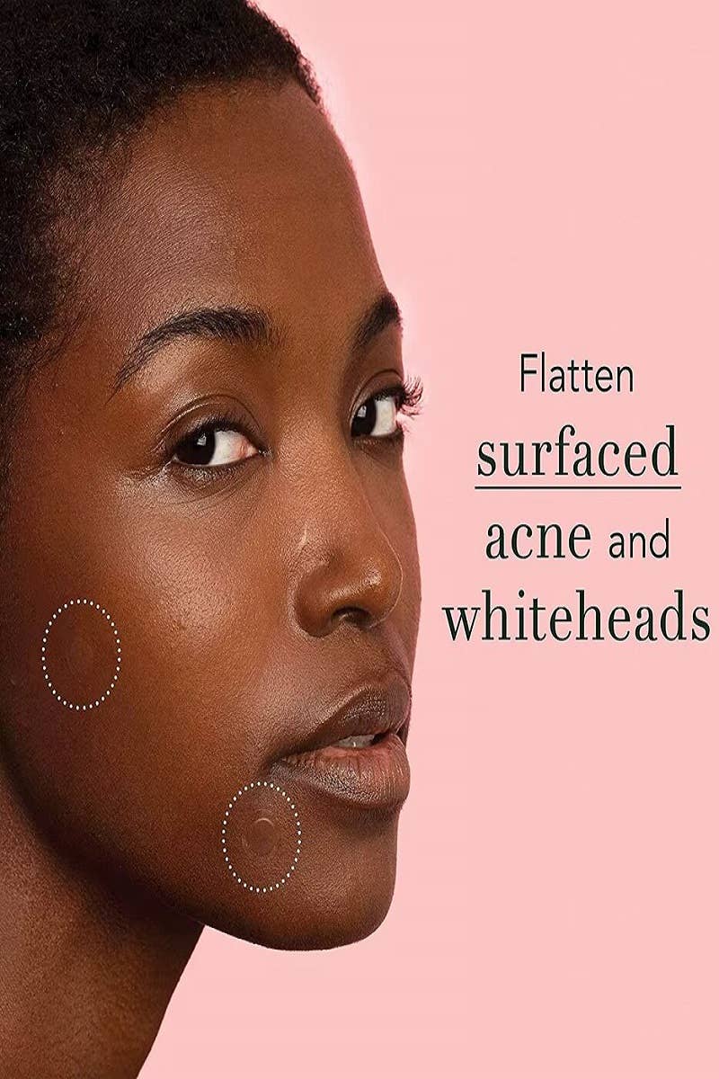 ,....1028 The Original Hydrocolloid Acne Pimple Patch  SI-27832