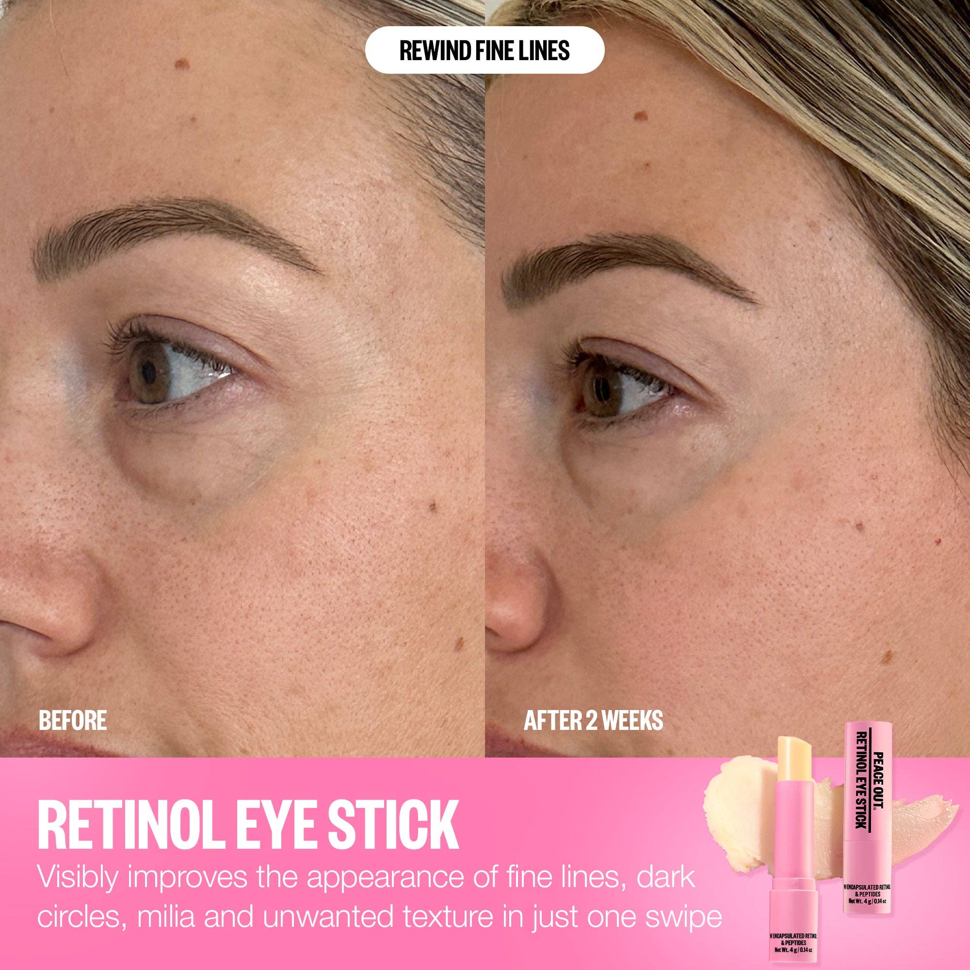 Retinol Eye Stick