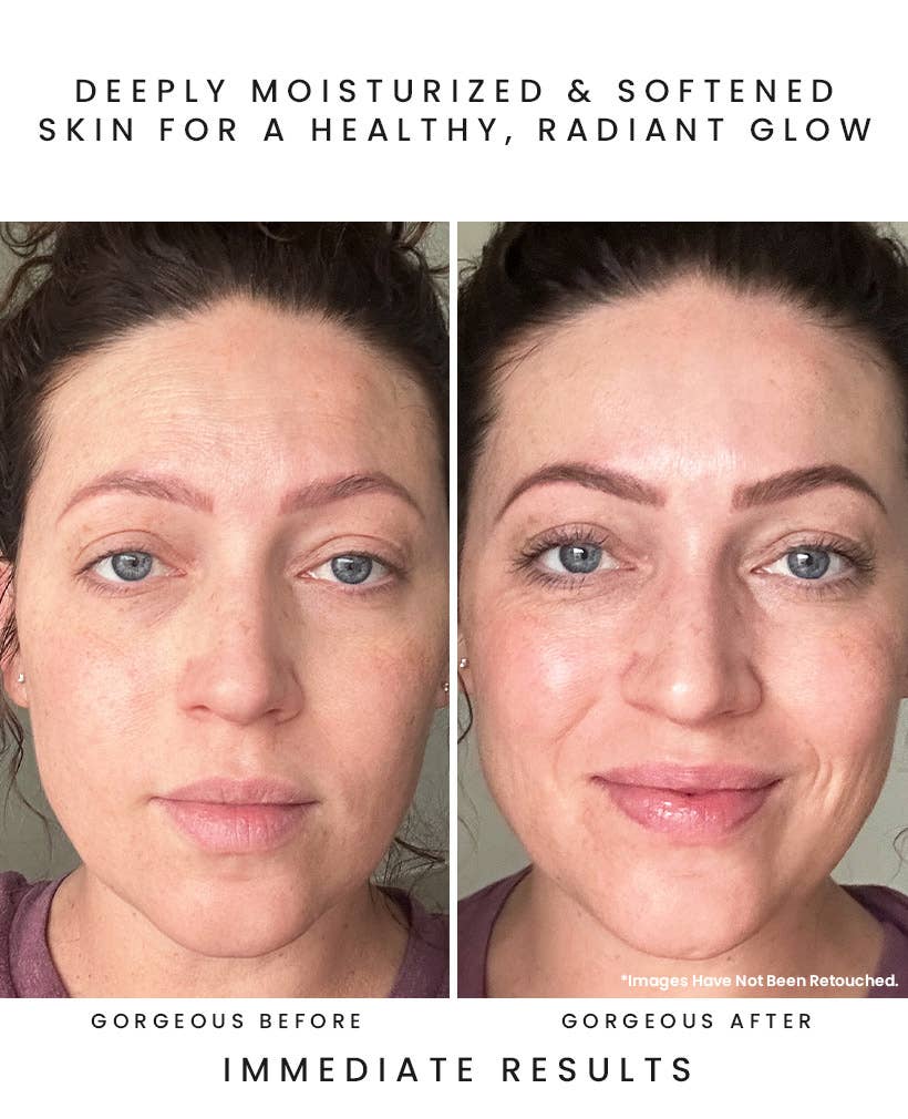 CALYPSO Antioxidant Glow Facial Oil: Sea Vitamin C + CoQ10