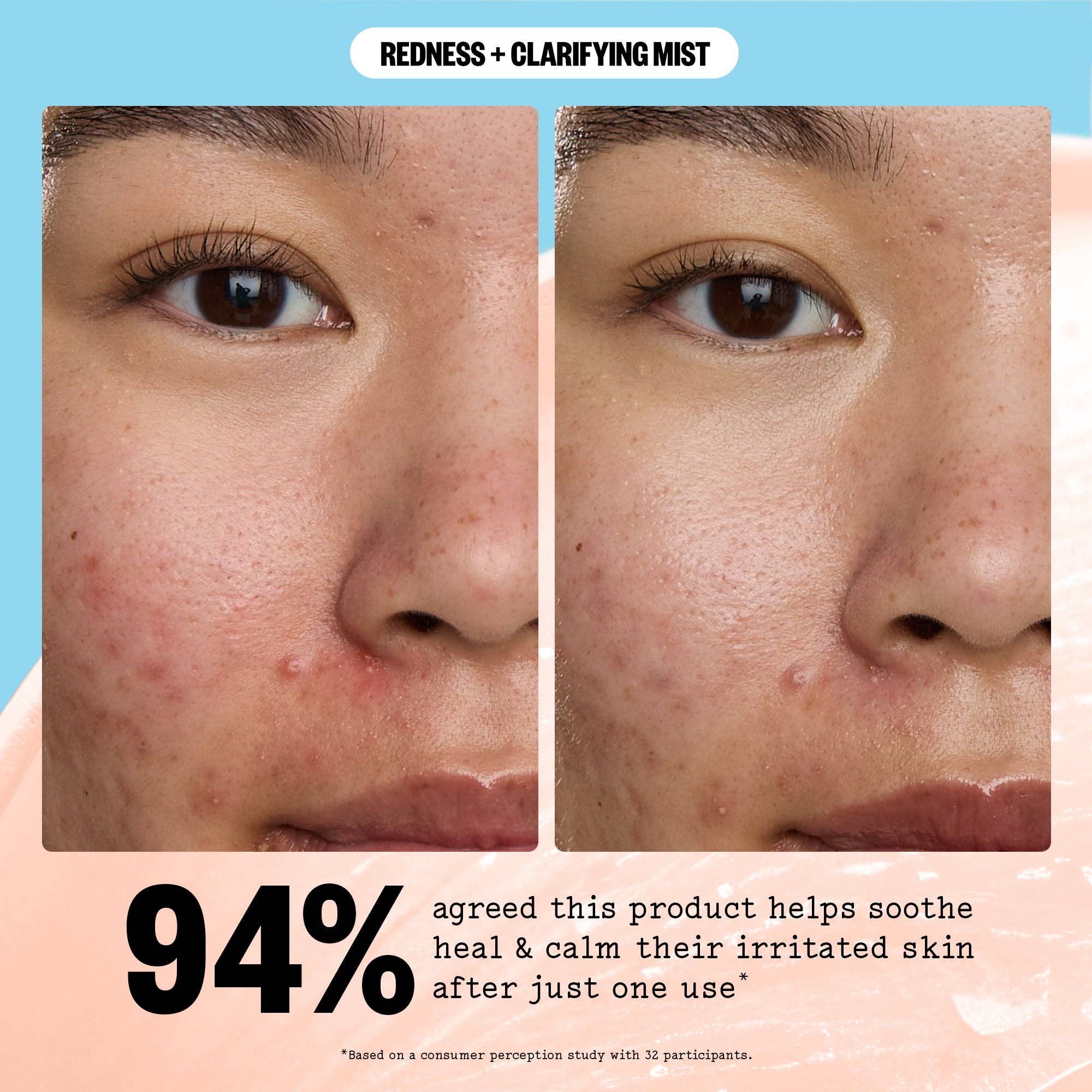 Redness + Clarifying Mist